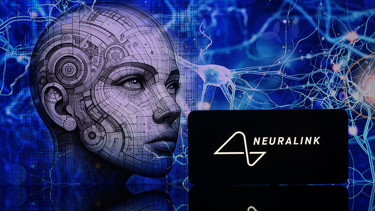 Bệnh nhân thử nghiệm Neuralink đầu tiên đã dùng nó để thức trắng đêm chơi Civilization 6